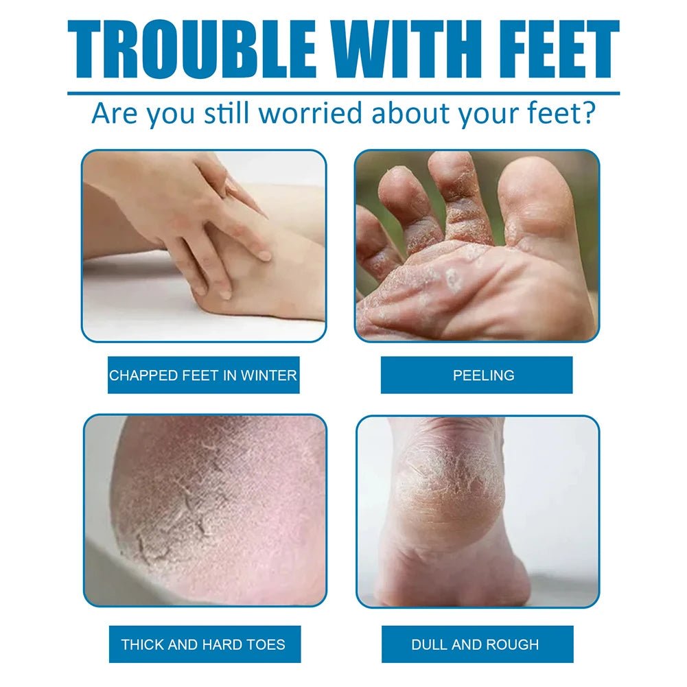 1 Pair Exfoliating Moisture Feet Mask Pedicure Cuticles Peel Off Dead Skin Remover Foot Care - Anti Spier - Anti Spier -