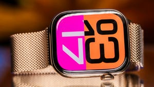 10 Ways Apple Can Make the Apple Watch Series 11 Worth the Upgrade