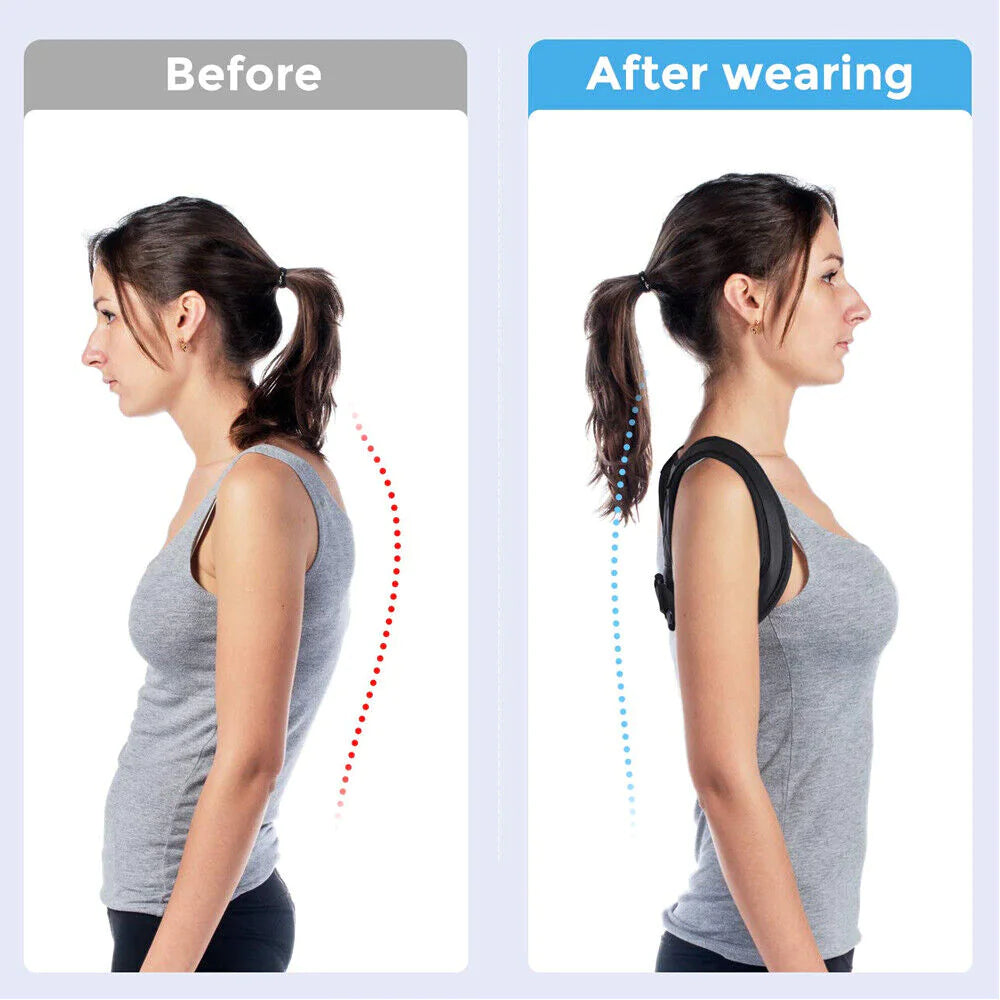 Posture Corrector Adjustable Back Brace Shoulder Support Clavicle Belt Men Women - Anti Spier 