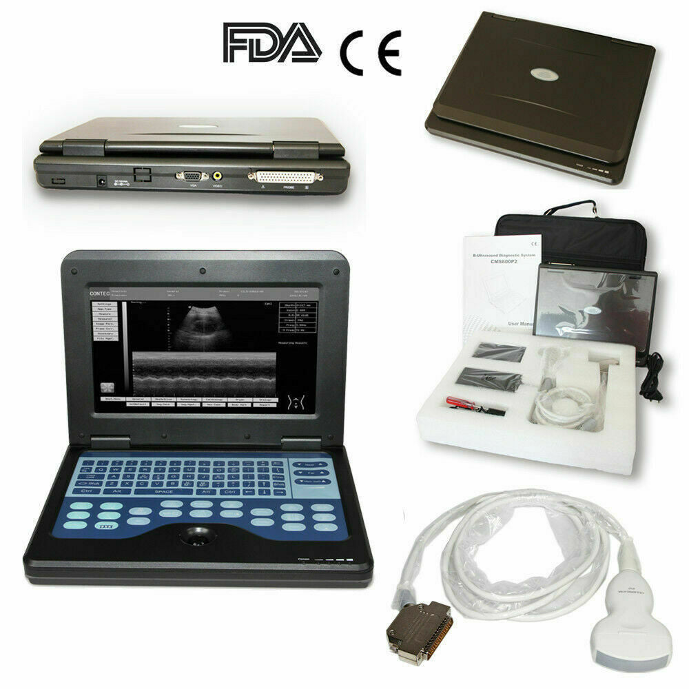 Digital Laptop Machine Ultrasound Scanner Convex 3.5Mhz Probe Abdominal For Human Use