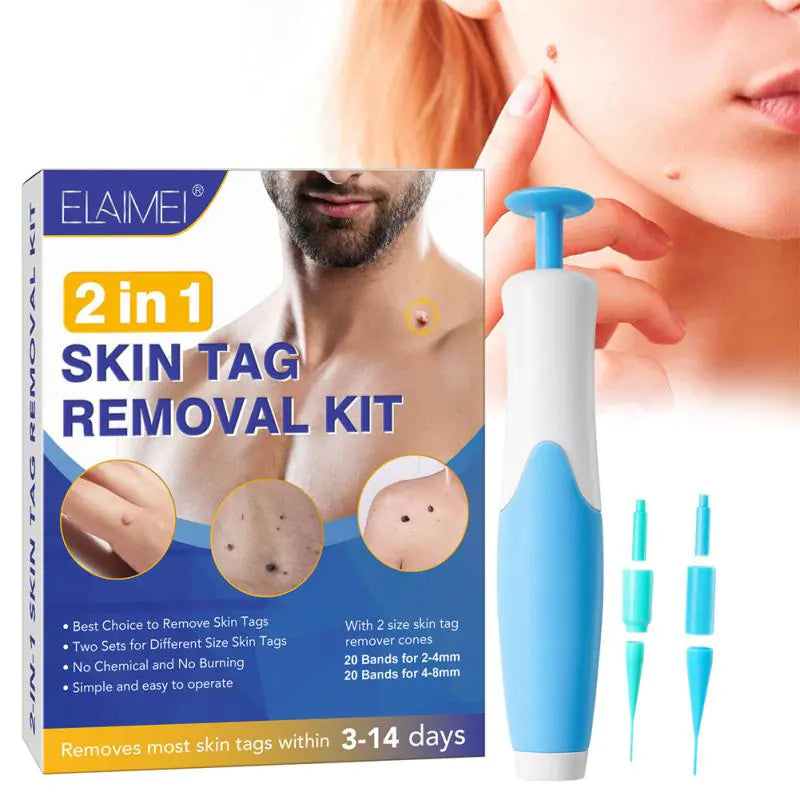 Auto Skin Tag Remover Kit